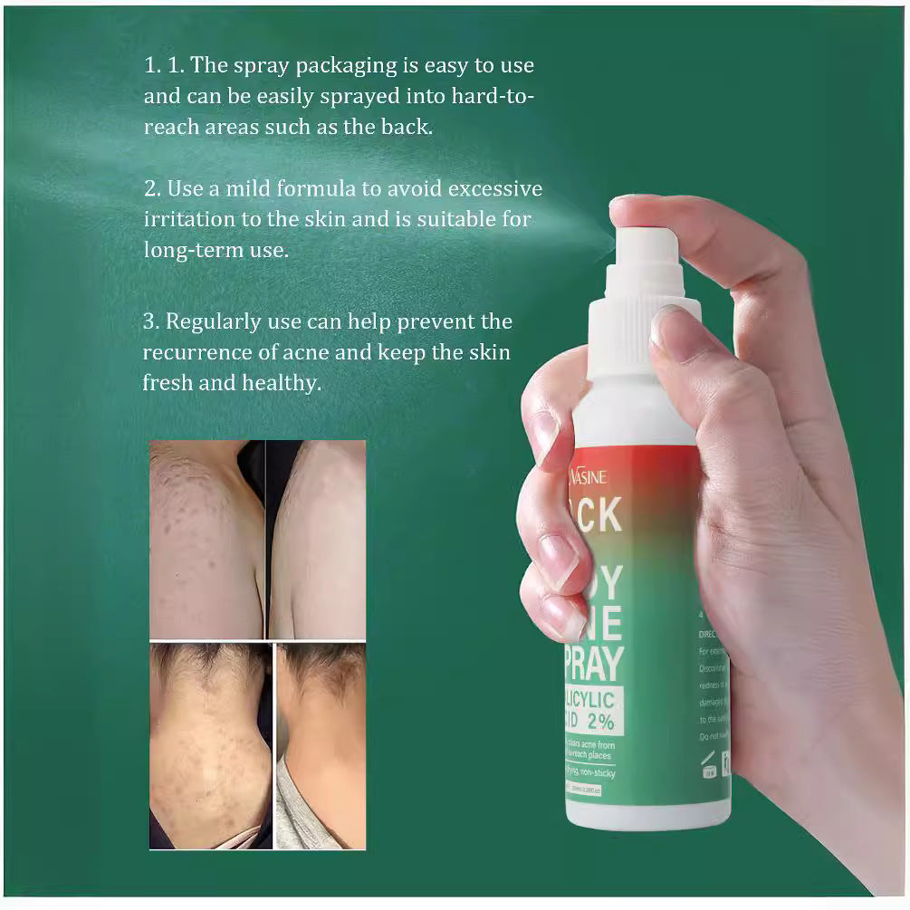 Sauvasine Body Back Acne Hydrating Spray